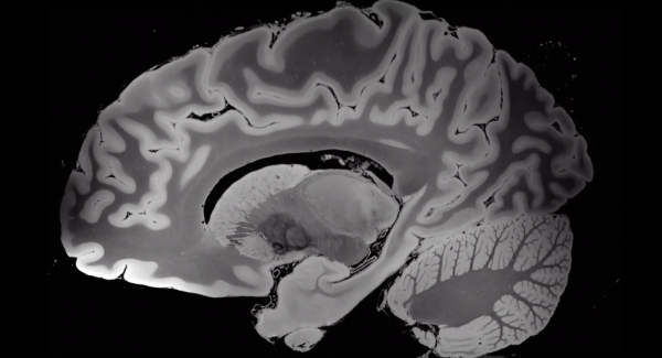 Ученые получили самые детальные изображения человеческого мозга. Им пришлось проводить МРТ более 100 часов! 1